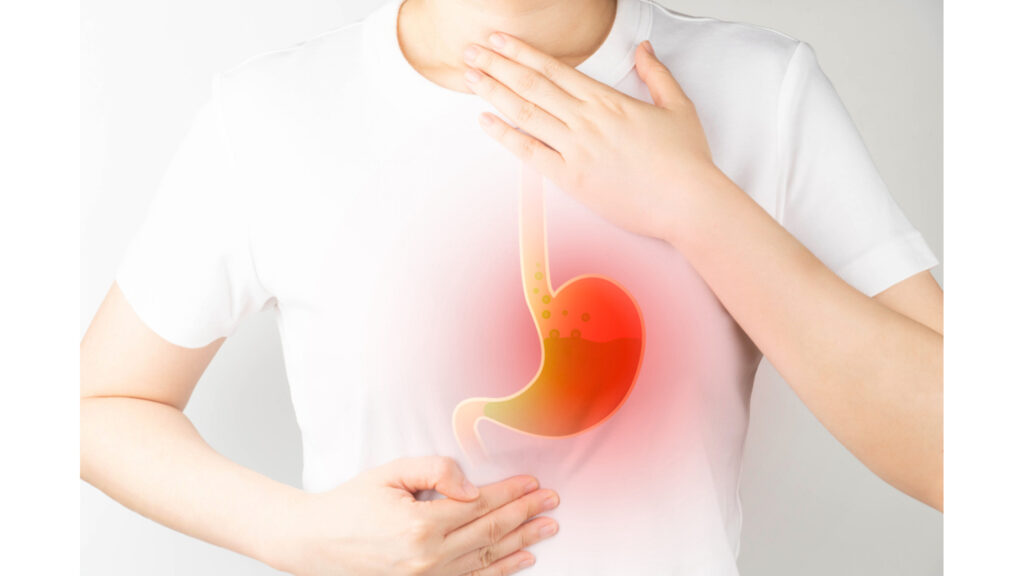 Gastroesophageal Reflux Disease (GERD) – Symptoms, Causes and Treatment.