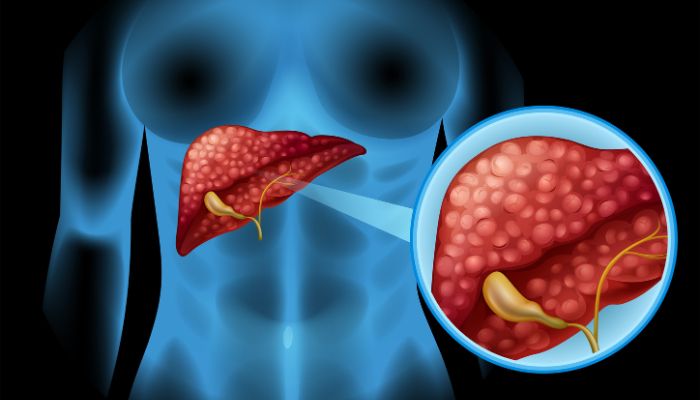 Best Liver Specialist in Ahmedabad–Expert Liver Care|SN Gastro